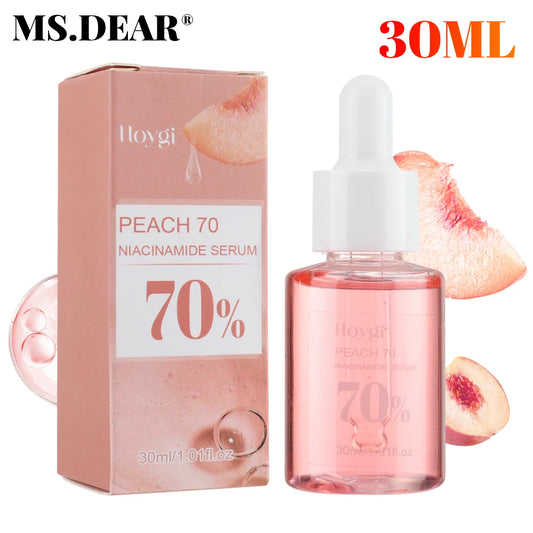 30ml Niacinamide Serum